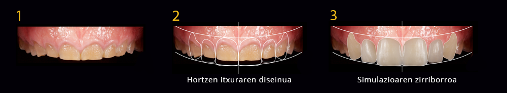Irribarrearen Diseinu Digitala