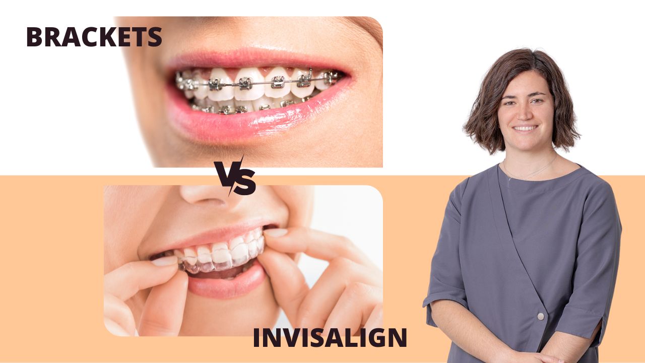 Brackets vs. Invisalign - Ainhoa Ochagavia