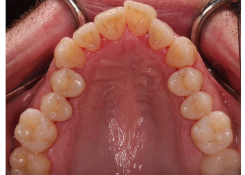 Endika caso Endika caso