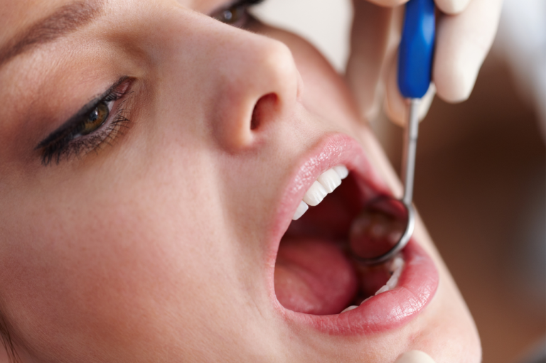 lesiones orales - Clínica Dental Urumea