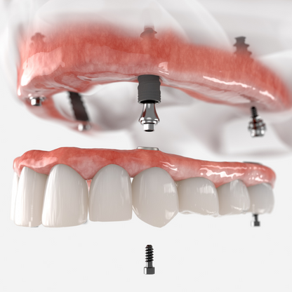 Prótesis dental Clinica Dental Urumea
